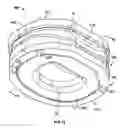 Fig. 13 - TOROID-SHAPED SPINAL DISC