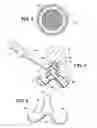Fig. 03 - Artificial wear resistant plug for mounting to existing joint bone