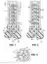 Fig. 02 - Composite joint implant incorporating inner extending stem with outwardly displaceable branches for securing to a sectioned bone end