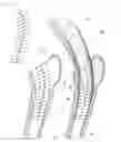 Fig. 01 - Method of determining shape of artificial cementless hip prosthesis stem