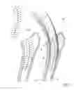 Fig. 02 - Method of determining shape of artificial cementless hip prosthesis stem