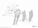 Fig. 05 - Method of determining shape of artificial cementless hip prosthesis stem