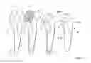 Fig. 09 - Method of determining shape of artificial cementless hip prosthesis stem