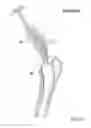 Fig. 28 - Method of determining shape of artificial cementless hip prosthesis stem