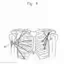 Fig. 07 - Upper garment