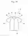 Fig. 20 - Upper garment