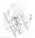 Fig. 55 - Motorized traction device for a patient support