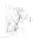 Fig. 58 - Motorized traction device for a patient support