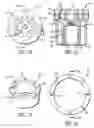 Fig. 05 - Scrubbing razor