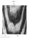Fig. 08 - Door skin, a method of etching a plate for forming a wood grain pattern in the door skin, and an etched plate formed therefrom