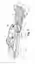 Fig. 02 - Hull safety and protective device