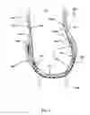 Fig. 08 - Protective bodysuit