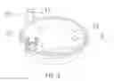 Fig. 15 - REPLACEABLE HOLLOW FIBER MEMBRANE FILTER DEVICE