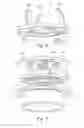 Fig. 04 - Fluid filter