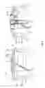 Fig. 09 - Device for holding beverage