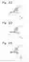 Fig. 04 - Dispensing device
