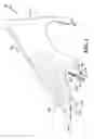 Fig. 02 - Reinforcement bracket and related methods for on-line painting