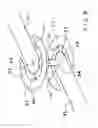 Fig. 04 - Multilayer microstripline transmission line transition