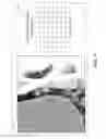 Fig. 09 - Uncertainty maps for segmentation in the presence of metal artifacts