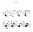Fig. 06 - Induction of thyroid iodide-handling gene expression in human cancers