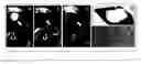 Fig. 01 - Targeted radiotherapy