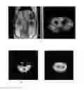 Fig. 01 - MR IMAGING AGENT, IMAGING MEDIUM AND METHODS OF IMAGING WHEREIN SUCH AN IMAGING MEDIUM IS USED