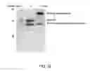Fig. 11 - COMPLEXING SYSTEM