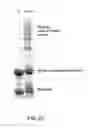 Fig. 20 - COMPLEXING SYSTEM