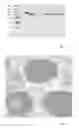 Fig. 09 - Method for the Production of Human Recombinant Lysosomal Enzymes in a Cereal Endosperm