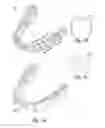 Fig. 02 - Method of forming a dental appliance