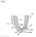 Fig. 02 - Method and device for determining the apical position in a dental root canal