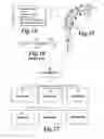 Fig. 07 - COMPUTER AIDED CANAL INSTRUMENTATION SYSTEM AND A UNIQUE ENDODONTIC INSTRUMENT DESIGN
