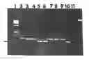 Fig. 01 - Method of detecting tumor-associated DNA in plasma or serum from humans without cancer