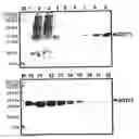 Fig. 01 - METHOD OF IMMUNOLOGICAL ANALYSIS FOR DETECTION OF ANTIBODIES AGAINST HUMAN GSTT1 (ANTI-HGSTT1)