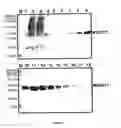 Fig. 02 - METHOD OF IMMUNOLOGICAL ANALYSIS FOR DETECTION OF ANTIBODIES AGAINST HUMAN GSTT1 (ANTI-HGSTT1)
