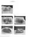 Fig. 05 - Methods of efficiently establishing induced pluripotent stem cells under hypoxic conditions