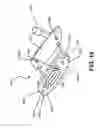 Fig. 17 - Putter heads and putters including polymeric material as part of the ball striking face