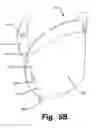 Fig. 12 - WEIGHT ELEMENT FOR A GOLF CLUB