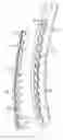 Fig. 01 - Racquet having articulating grommet assemblies