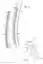 Fig. 03 - Racquet having articulating grommet assemblies