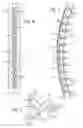 Fig. 04 - Racquet having articulating grommet assemblies