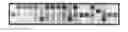 Fig. 01 - APPARATUS AND METHODS FOR APPLICATIONS OF GENOMIC MICROARRAYS IN SCREENING, SURVEILLANCE AND DIAGNOSTICS