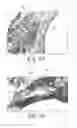 Fig. 09 - THERAPEUTIC COMPOSITION FOR BONE INFECTIOUS DISEASE