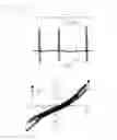 Fig. 05 - COMPOSITION FOR TREATMENT OF ERECTILE DYSFUNCTION
