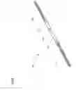 Fig. 04 - Apparatus comprising a drive cable for a medical device (II)