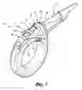 Fig. 02 - Closure system for tubular organs