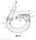 Fig. 03 - Closure system for tubular organs