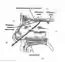 Fig. 01 - Method and apparatus for weight control by olfactory nerve ablation
