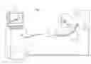 Fig. 02 - Robotic drive for catheter