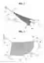Fig. 02 - Surgical retractor